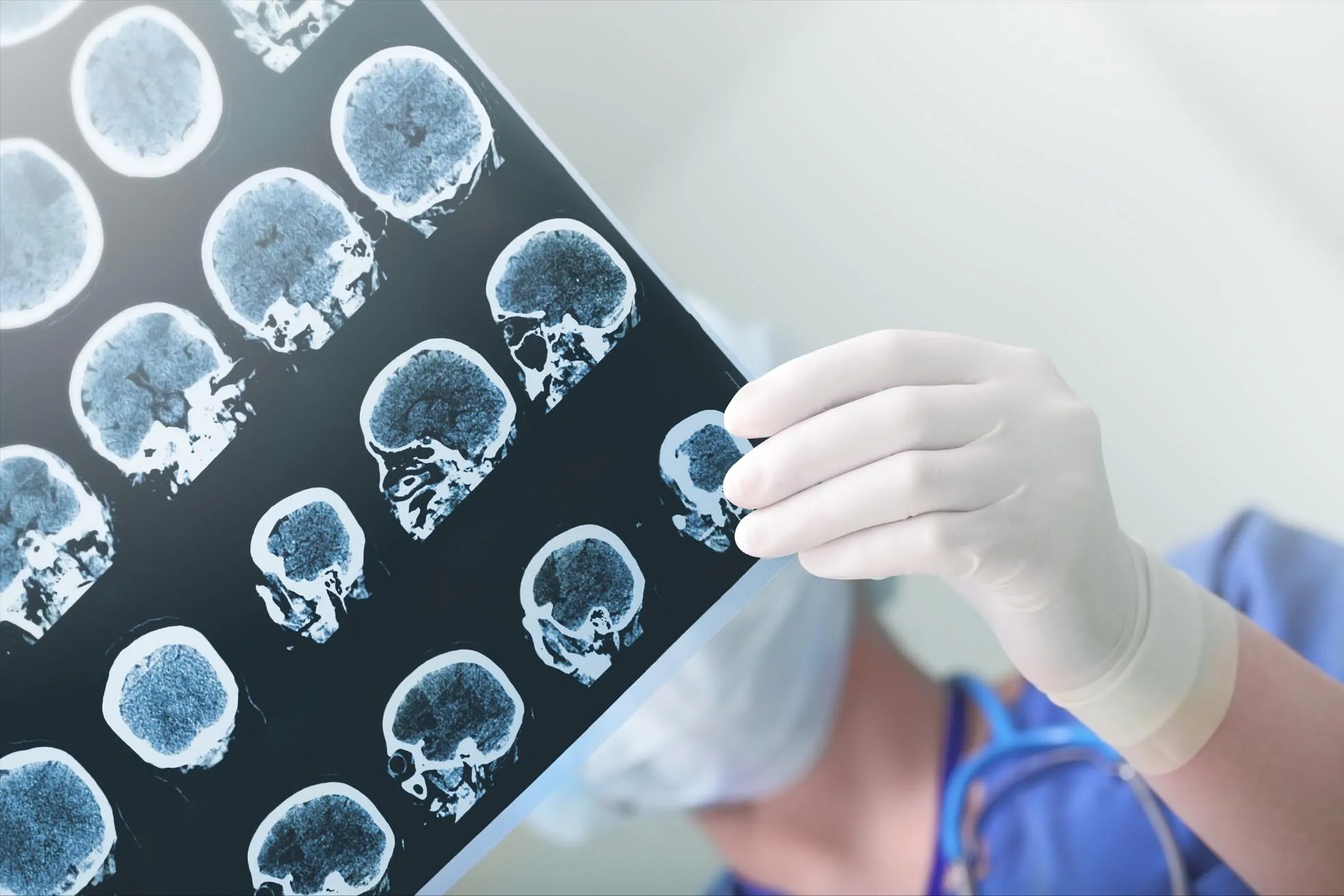 Coral Springs Traumatic Brain Injury Lawyer