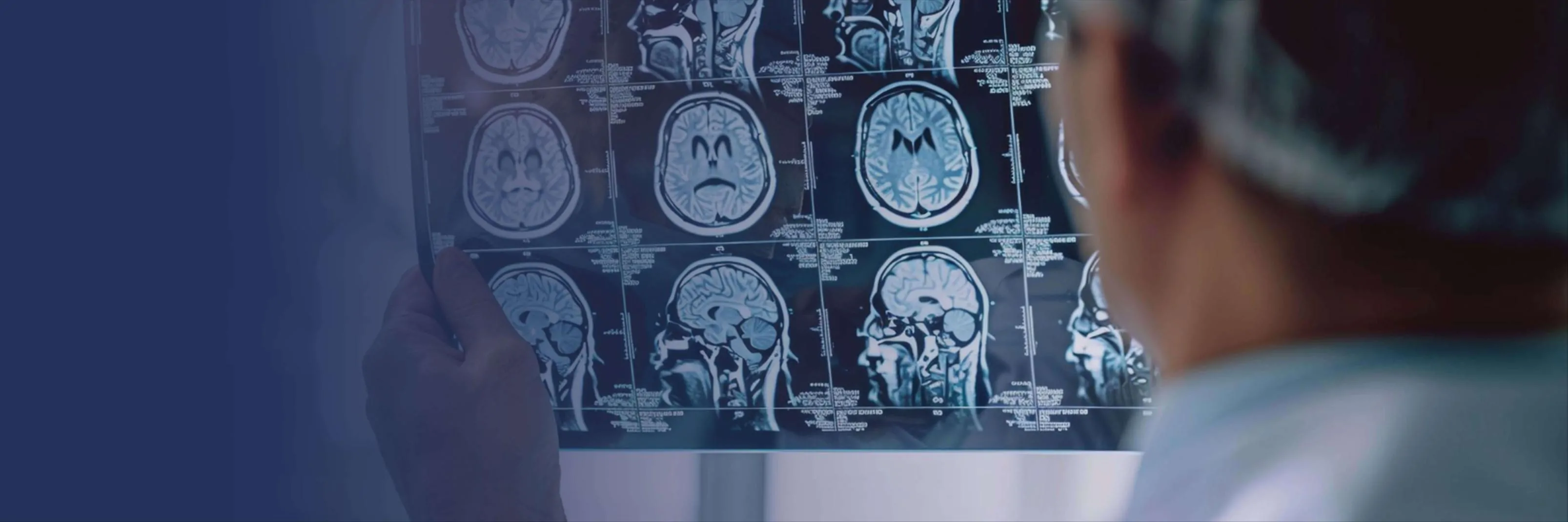 Traumatic Brain Injury Lawyer